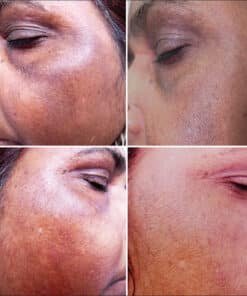 CETYL TRANEXAMATE HCL (TXC™).